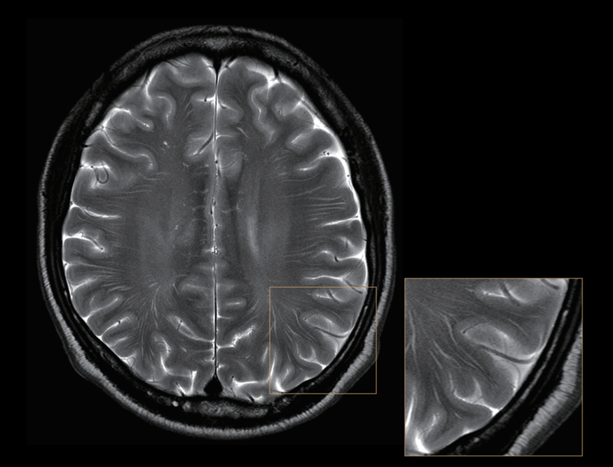 0.1mm High-resolution head imaging